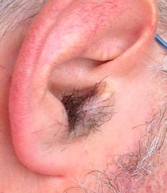 ear